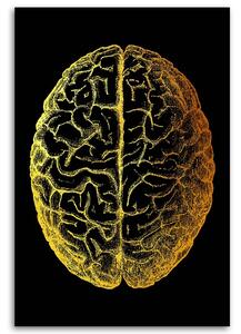 Gario Vászonkép Arany anatómia, az agy teteje - Gab Fernando Méret: 40 x 60 cm