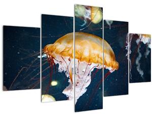 Medúza képe (150x105 cm)