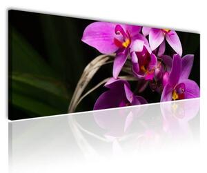 100x70 cm - Élő orchidea vászonkép
