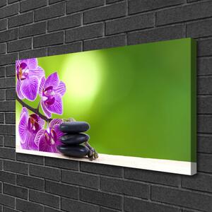 Vászonkép Orchideák zöld virágok