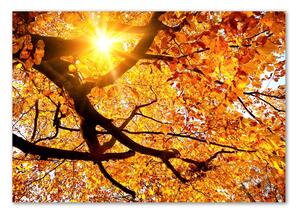 Egyedi üvegkép Korona őszi fák