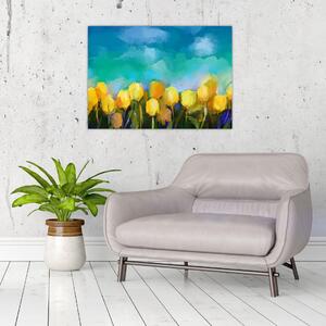 Sárga tulipán képe (70x50 cm)