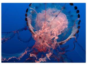 Medúza képe (70x50 cm)