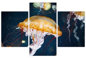 Medúza képe (90x60 cm)