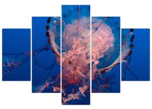 Medúza képe (150x105 cm)