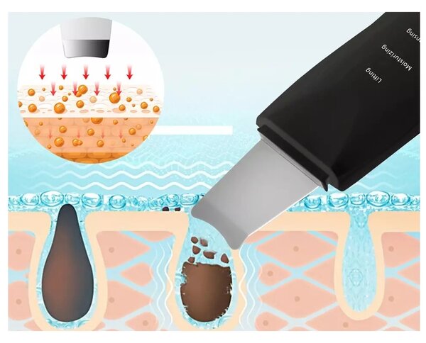 Black kozmetikai ultrahangos spatula tartozékokkal